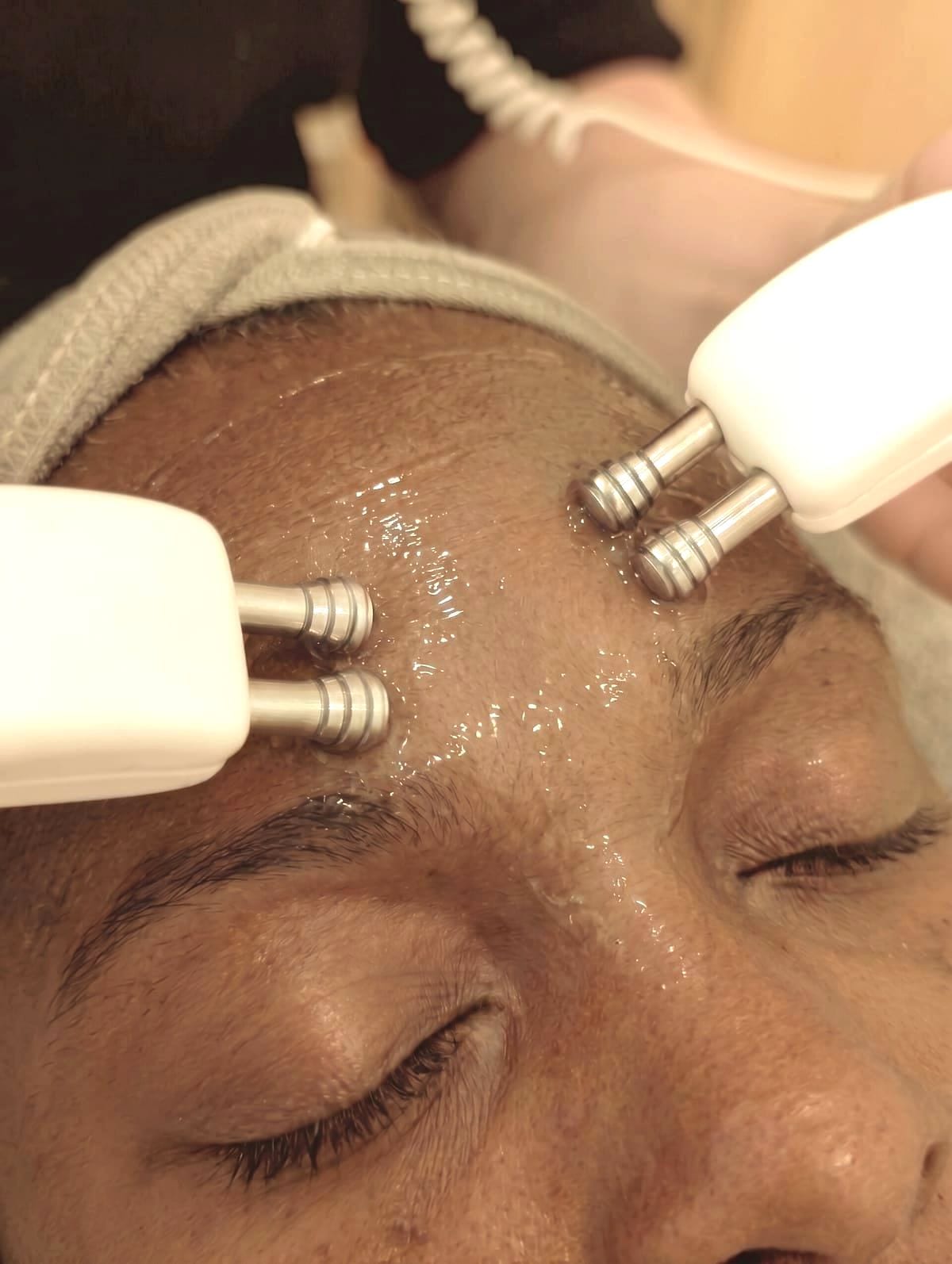 Dual microcurrent probes lifting and sculpting the forehead during a facial treatment